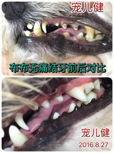 潔牙手術